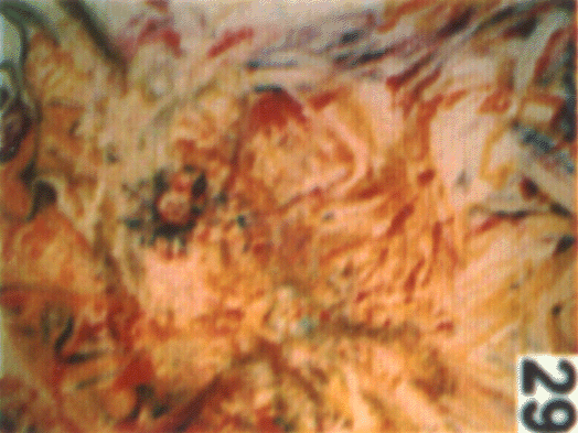 Painting by the Friedrichshain artist Ralf Splettstößer.